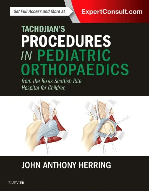 Tachdjian's Procedures in Pediatric Orthopaedics
