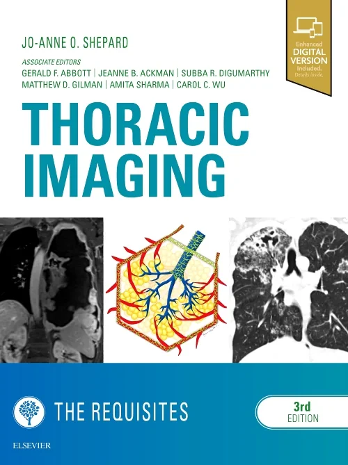 Coperta cărții "Thoracic Imaging The Requisites, 3e" de autor necunoscut