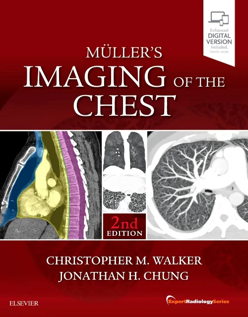 Muller's Imaging of the Chest