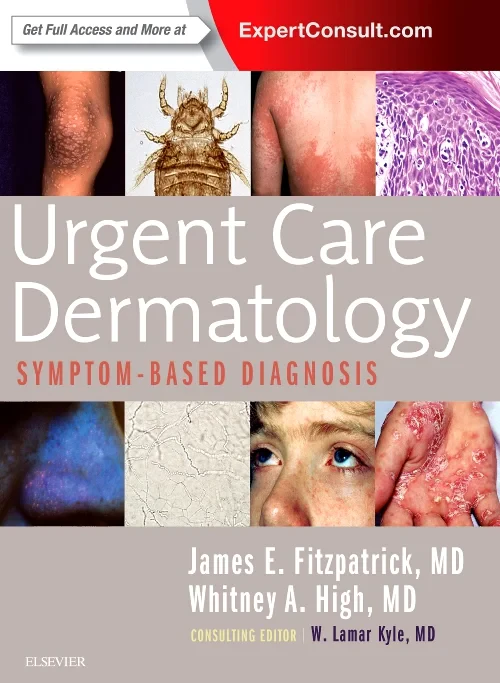 Coperta cărții "Urgent Care Dermatology: Symptom-Based Diagnosis, 1e" de autor necunoscut