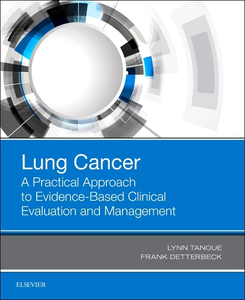 Lung Cancer: A Practical Approach to Evidence-Base...