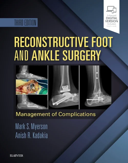 Reconstructive Foot and Ankle Surgery: Management ...