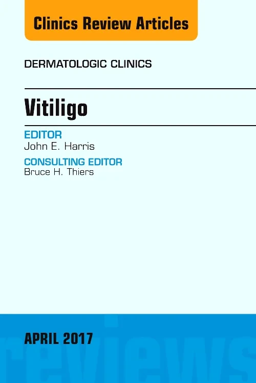 Coperta cărții "Vitiligo, An Issue of Dermatologic Clinics, Volume 35-2" de autor necunoscut