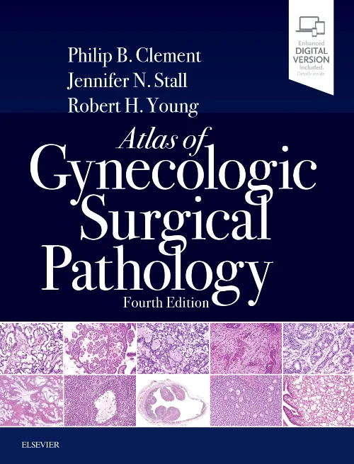 Coperta cărții "Atlas of Gynecologic Surgical Pathology, 4th Edition" de autor necunoscut