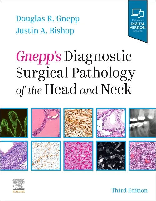 Coperta cărții "Gnepp&#039;s Diagnostic Surgical Pathology of the Head and Neck: Expert Consult - Online and Print" de autor necunoscut
