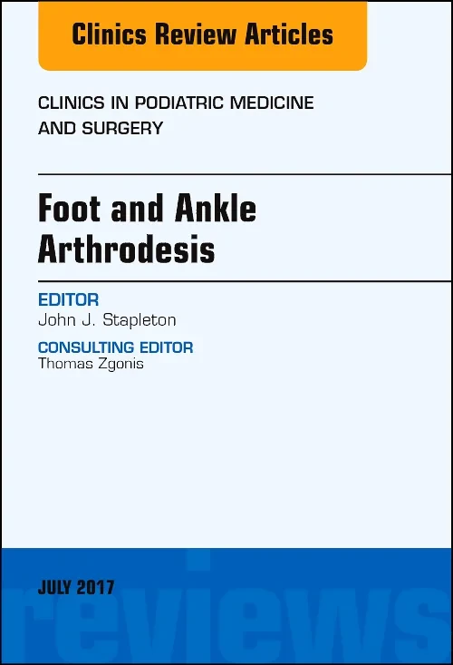 Foot and Ankle Arthrodesis, An Issue of Clinics in...