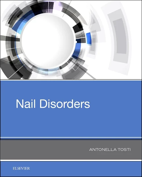 Coperta cărții "Nail Disorders" de autor necunoscut