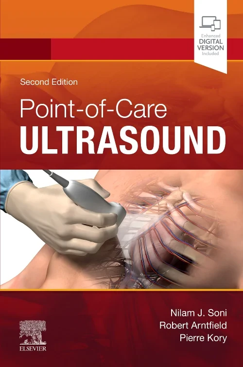 Coperta cărții "Point of Care Ultrasound, 2e" de autor necunoscut