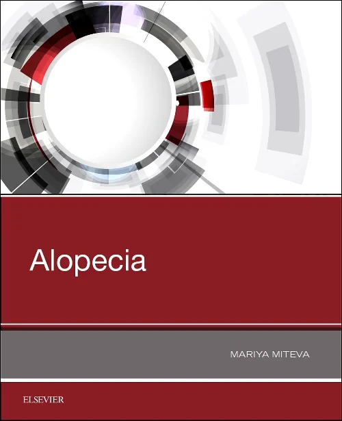 Coperta cărții "Alopecia" de autor necunoscut