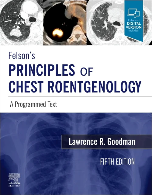 Felson's Principles of Chest Roentgenology, A Prog...