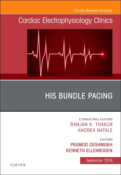 His Bundle Pacing, An Issue of Cardiac Electrophys...