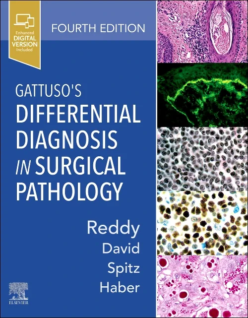 Coperta cărții "Gattuso&amp;#146;s Differential Diagnosis in Surgical Pathology" de autor necunoscut