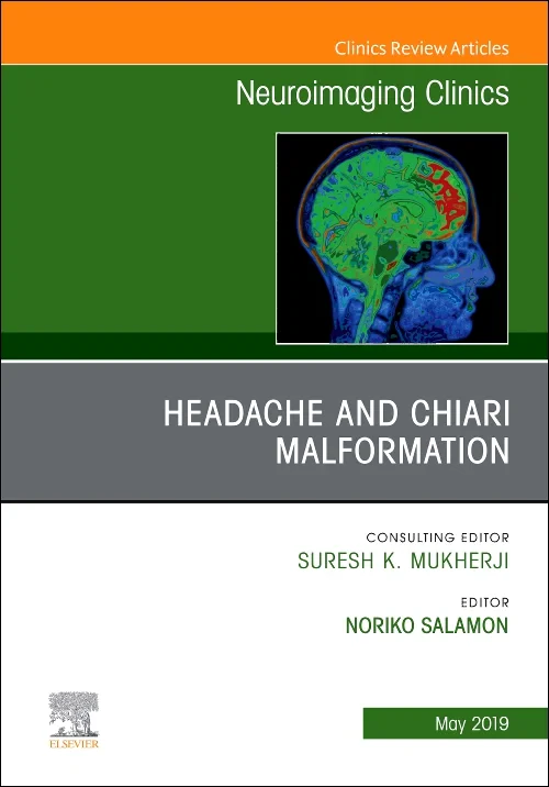 Headache and Chiari Malformation, An Issue of Neur...