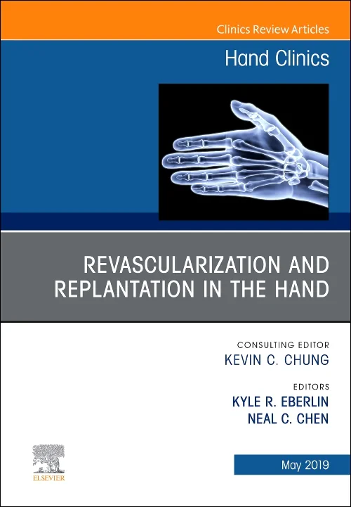 Revascularization and Replantation in the Hand, An...