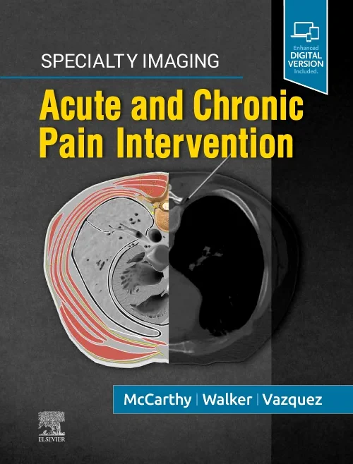 Specialty Imaging: Acute and Chronic Pain Interven...