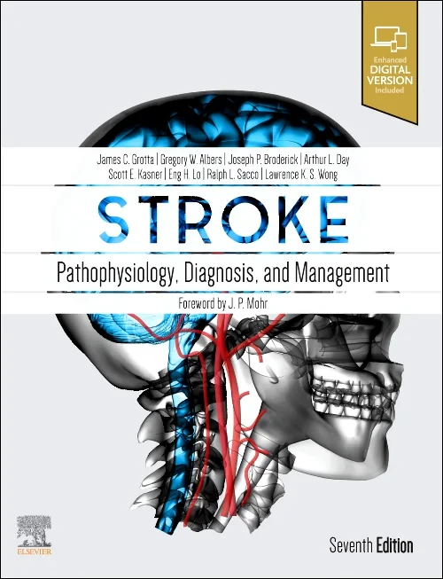 Coperta cărții "Stroke: Pathophysiology, Diagnosis, and Management" de autor necunoscut