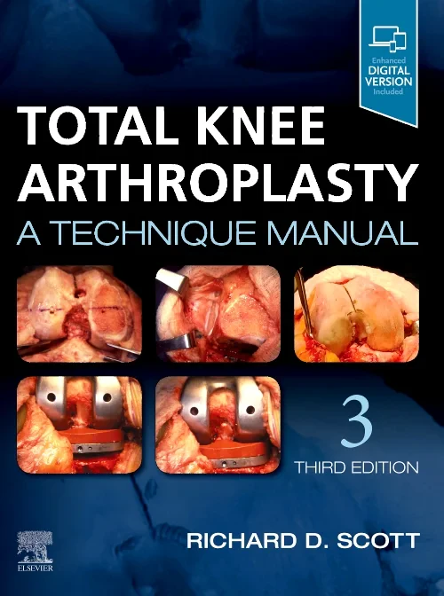 Total Knee Arthroplasty