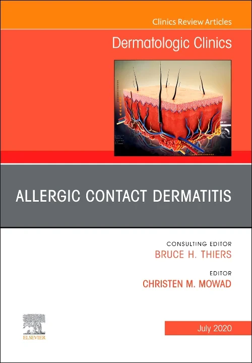 Allergic Contact Dermatitis, An Issue of Dermatolo...