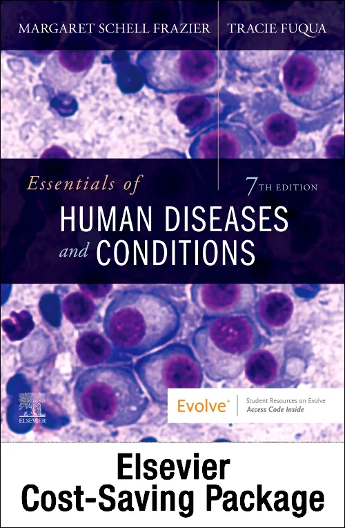 Essentials of Human Diseases and Conditions - Text...