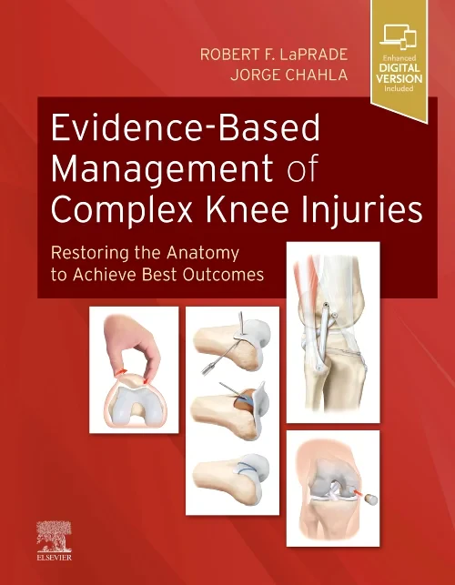 Coperta cărții "Evidence-Based Management of Complex Knee Injuries: Restoring the Anatomy to Achieve Best Outcomes" de autor necunoscut
