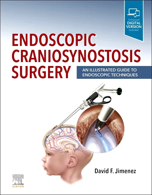 Coperta cărții "Endoscopic Craniosynostosis Surgery" de autor necunoscut
