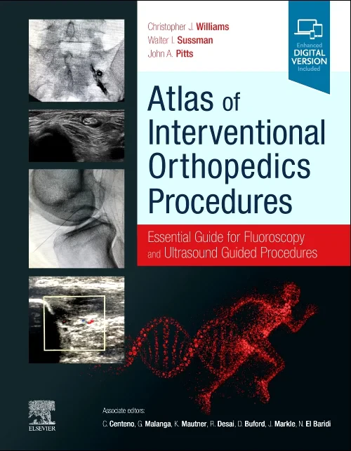 Coperta cărții "Atlas of Interventional Orthopedics Procedures: Essential Guide for Fluoroscopy and Ultrasound Guided Procedures" de autor necunoscut