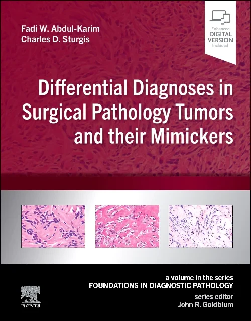 Differential Diagnoses in Surgical Pathology Tumor...
