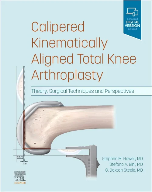 Calipered Kinematically aligned Total Knee Arthrop...