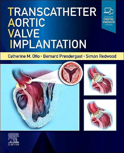 Transcatheter Aortic Valve Implantation