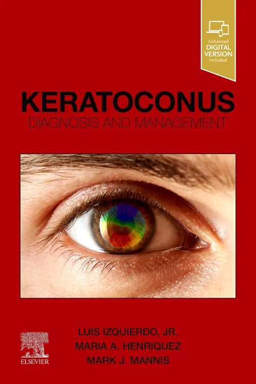 Coperta cărții "Keratoconus: Diagnosis and Management" de autor necunoscut