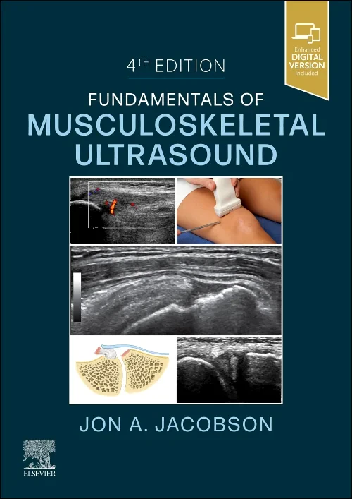 Fundamentals of Musculoskeletal Ultrasound