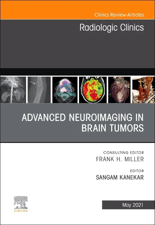 Advanced Neuroimaging in Brain Tumors, An Issue of...
