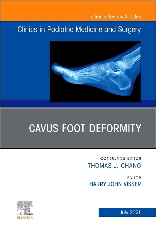 Cavus Foot Deformity, An Issue of Clinics in Podia...