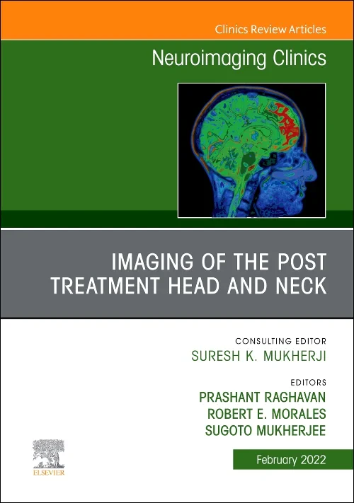 Imaging of the Post Treatment Head and Neck, An Is...