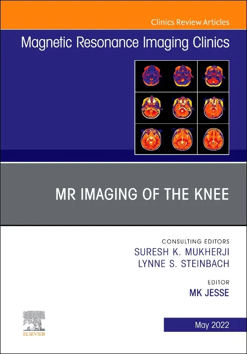 MR Imaging of The Knee, An Issue of Magnetic Reson...