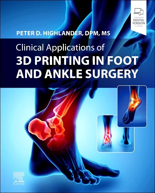 Clinical Applications of 3D Printing in Foot and A...