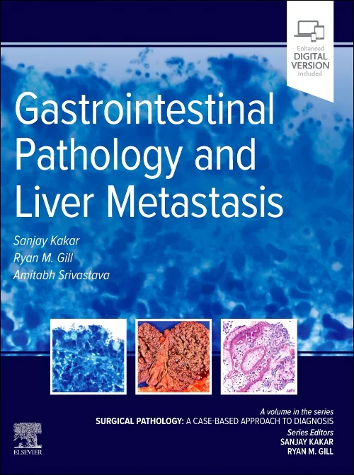 Gastrointestinal Pathology and Liver Metastasis: A...