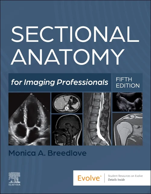 Coperta cărții "Sectional Anatomy for Imaging Professionals" de autor necunoscut