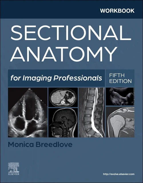 Coperta cărții "Workbook for Sectional Anatomy for Imaging Professionals" de autor necunoscut