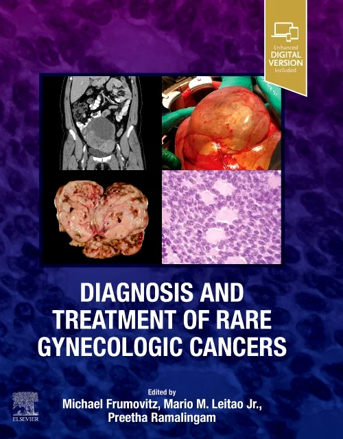 Diagnosis and Treatment of Rare Gynecologic Cancer...