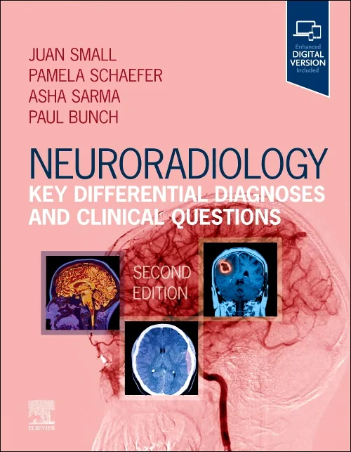 Neuroradiology: Key Differential Diagnoses and Cli...