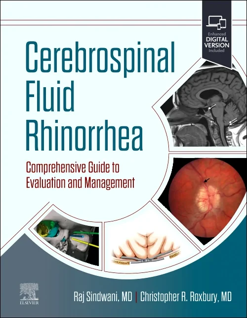 Coperta cărții "Cerebrospinal Fluid Rhinorrhea" de autor necunoscut