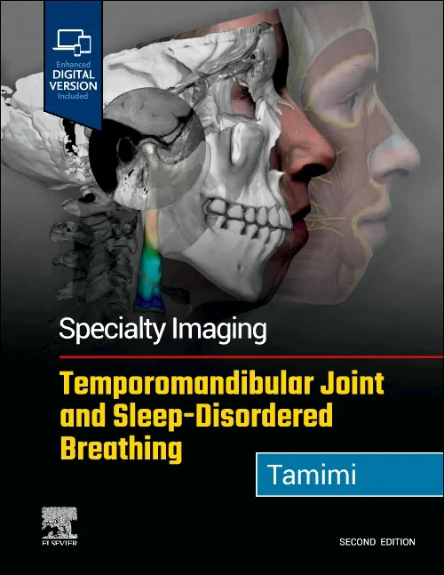 Specialty Imaging: Temporomandibular Joint and Sle...