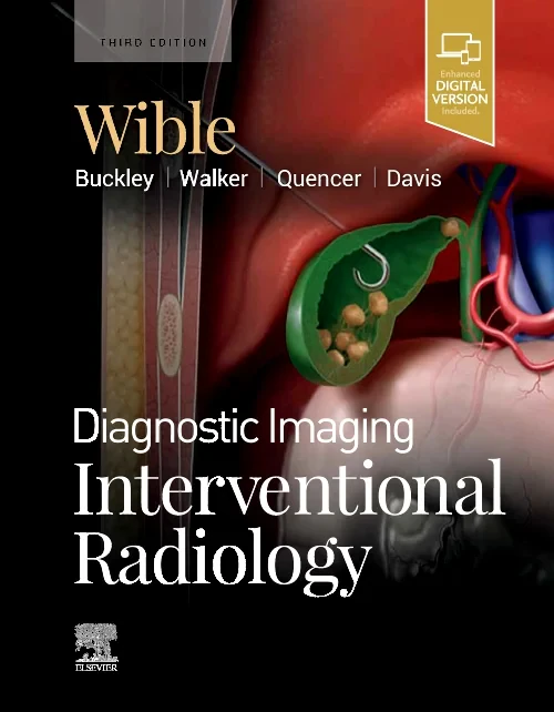 Diagnostic Imaging: Interventional Radiology