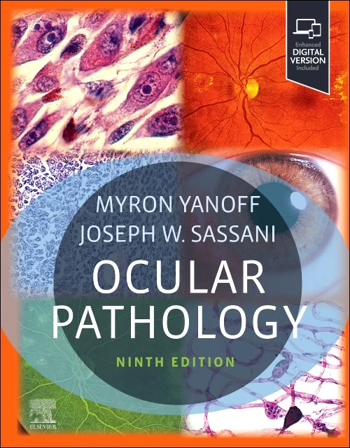 Coperta cărții "Ocular Pathology, 9th Edition" de autor necunoscut