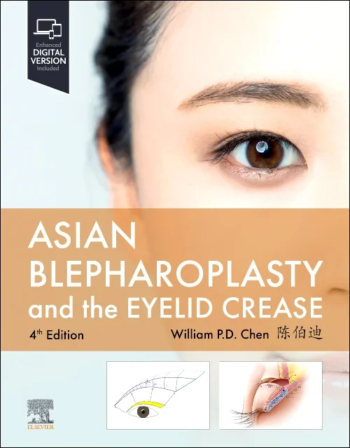 Asian Blepharoplasty and the Eyelid Crease