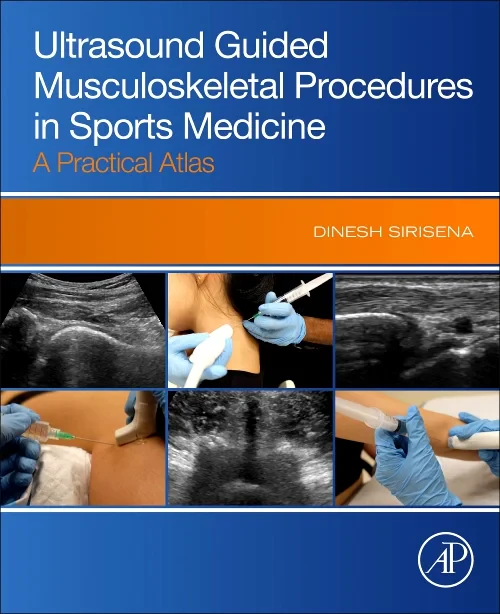 Ultrasound Guided Musculoskeletal Procedures in Sp...