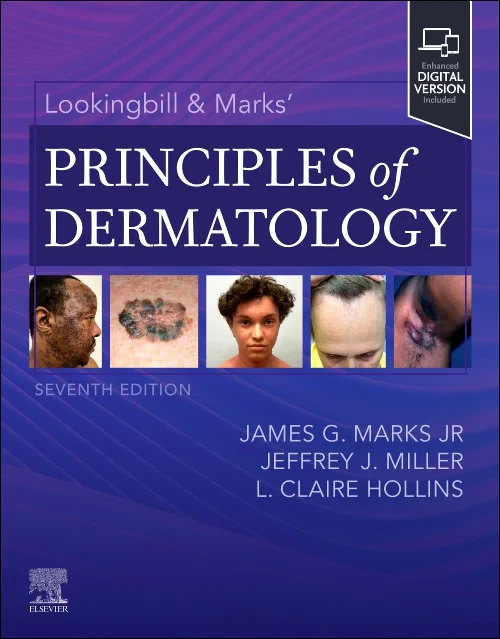 Lookingbill & Marks’ Principles of Dermatology