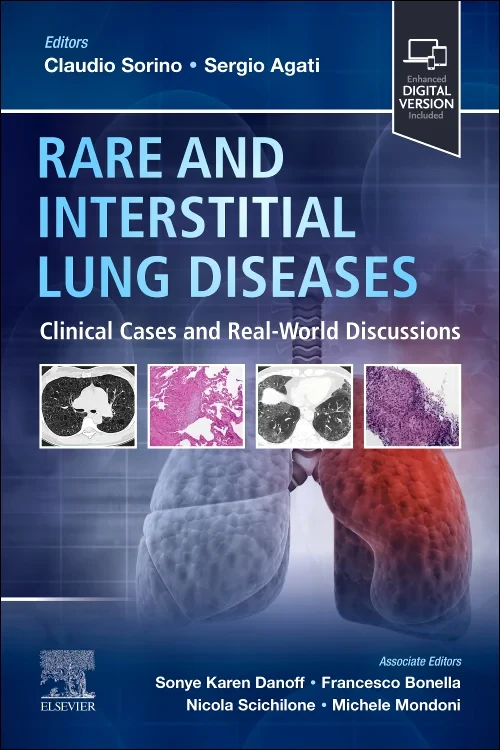 Coperta cărții "Rare and Interstitial Lung Diseases, 1st Edition" de autor necunoscut