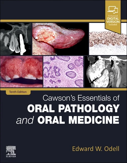 Cawson's Essentials of Oral Pathology and Oral Med...